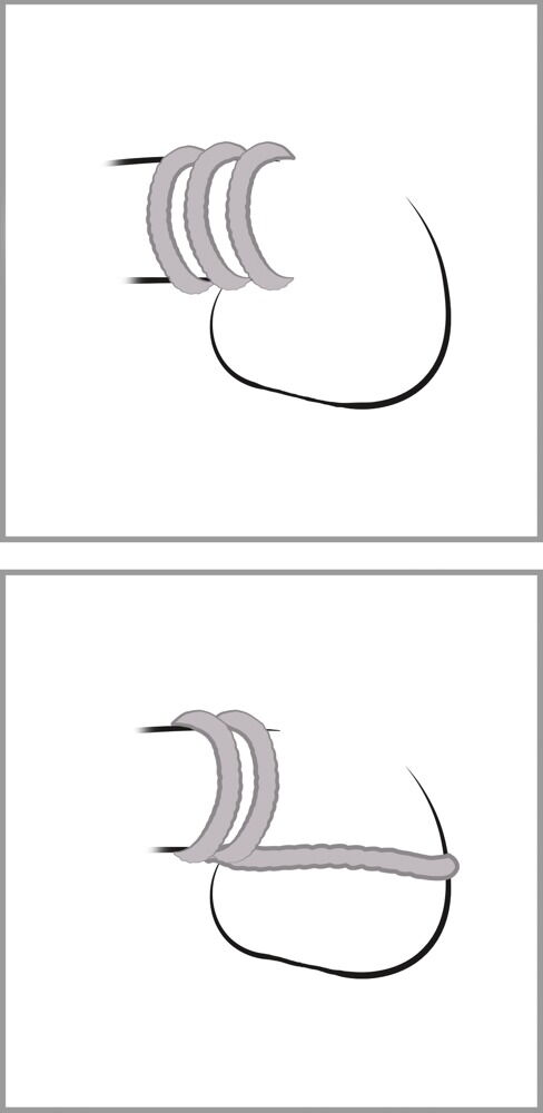 Penisringsæt "Trio"