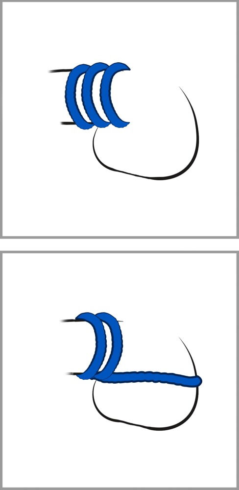 Penisringsæt "Trio"